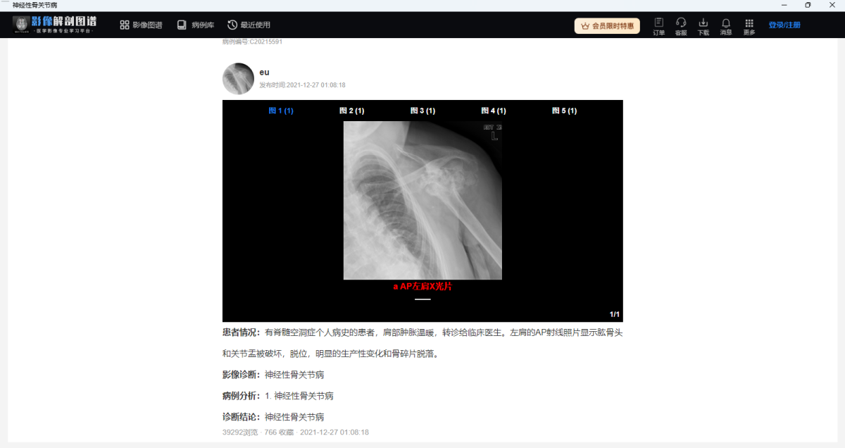 影像解剖图谱64位